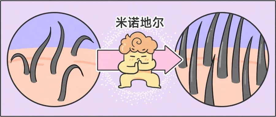 最新米诺地尔，变化的力量，自信与成长的奇迹之路