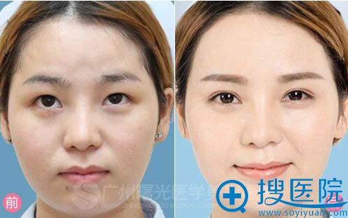 最新整容技术，重塑自信之美的艺术之旅